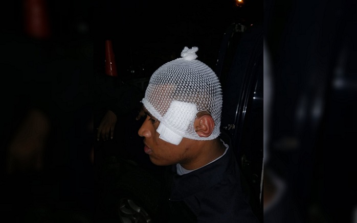 Arraiján 区 Veracruz 发生袭警事件 一名警员面部中弹受伤